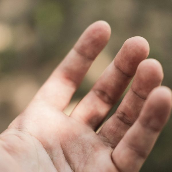 „Ich will Dir nicht zu nahe treten...“